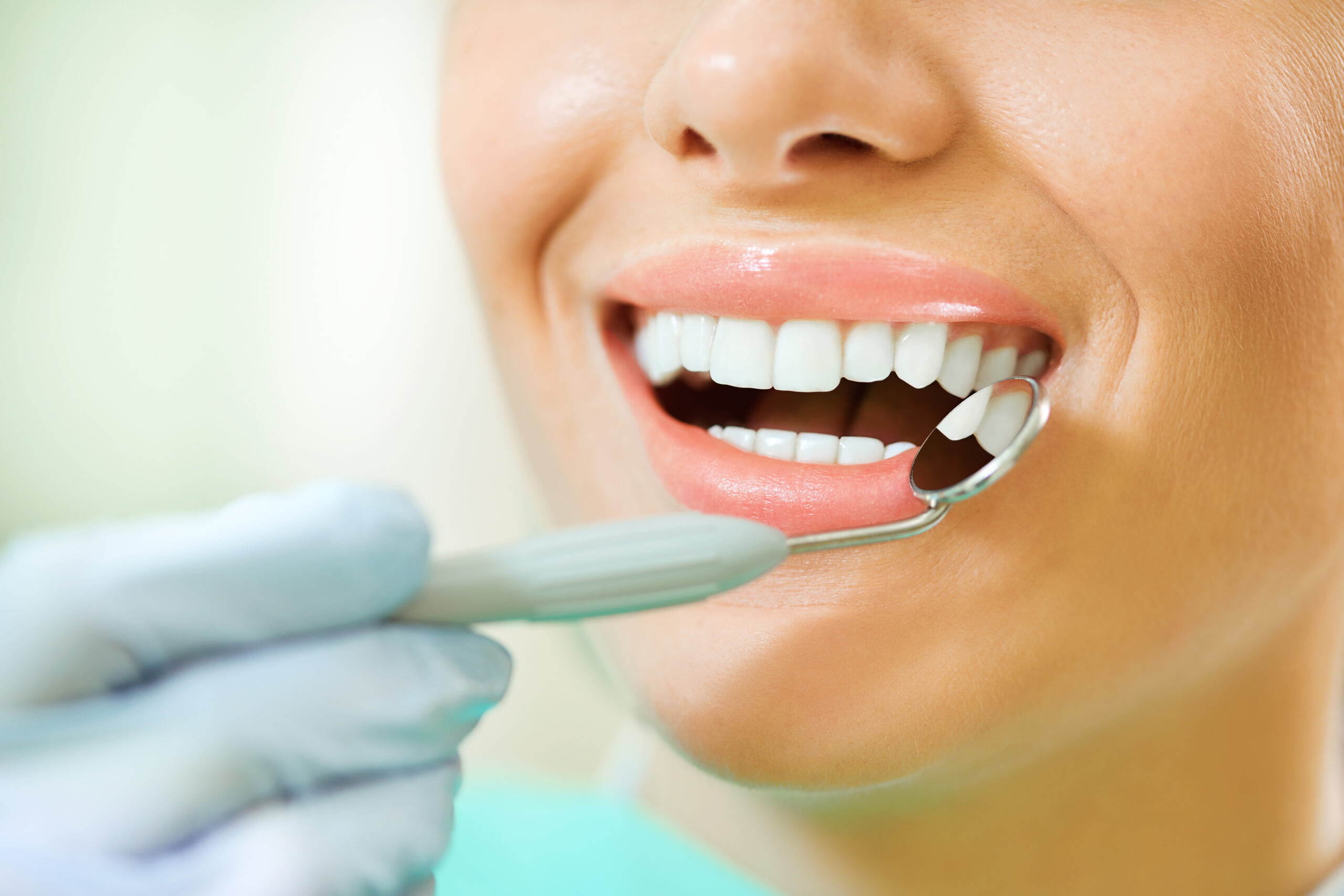 Dentist using mouth mirror to examine patient teeth for white spot lesions during cosmetic consultation